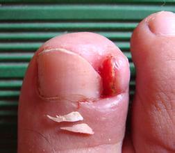 兰州北大皮肤科