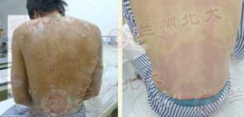 ����ţƤѢΣ�� ���ؿ�Σ������