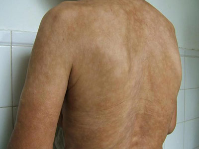 ��������֢״