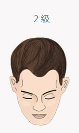 ���ݱ���Ƥ��ר��ҽԺFUEͷ�������������ŵ�