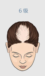 ���ݱ���Ƥ��ר��ҽԺ�˽��Լ�Ϊʲô���ѷ�