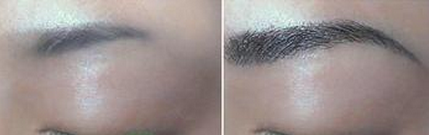 ���ݱ���Ƥ��ר��ҽԺ�����߸߸���ô��