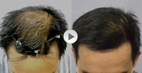 ���ݱ���Ƥ��ר��ҽԺ�ڹ淶�����в����ƽ�ҽԺ��������