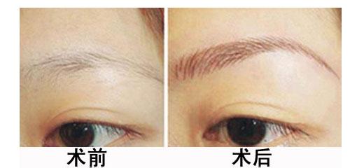 ���ݱ���Ƥ��ר��ҽԺ�ļ������Ԥ���ѷ�