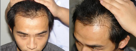 ���ݱ���Ƥ��ר��ҽԺͷ����ֲ�������������أ�