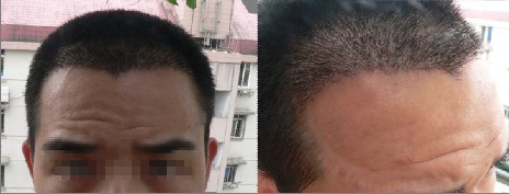 ���ݱ���Ƥ��ר��ҽԺͷ����ֲ�ļҺ�