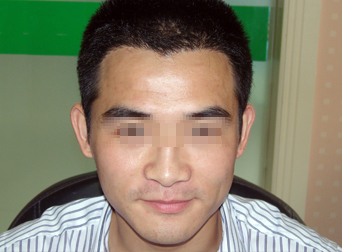 ���ݱ���Ƥ��ר��ҽԺͷ��ϡ����ô��Ũ��