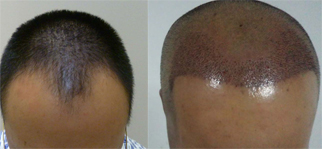 ���ݱ���Ƥ��ר��ҽԺ��μ����ѷ�