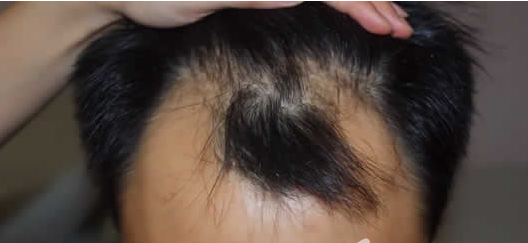 ���ݱ���Ƥ��ר��ҽԺ���ϴ������ȷ