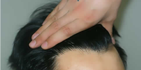 ���ݱ���Ƥ��ר��ҽԺ��η�ֹ�ѷ��ǹؼ�