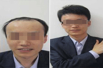 ���ݱ���Ƥ��ר��ҽԺ�����ѷ�����Щ����������