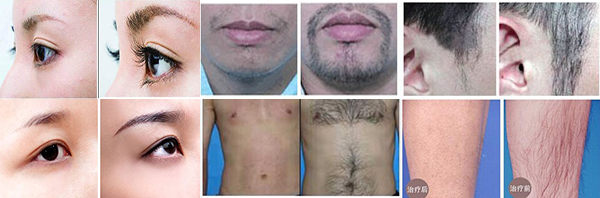 ���ݱ���Ƥ��ר��ҽԺ���������Ԥ���ѷ���