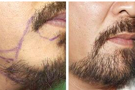 ���ݱ���Ƥ��ר��ҽԺ��ʲô�õķ��������ѷ���