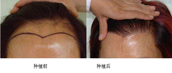 ���ݱ���Ƥ��ר��ҽԺֲ������  ��ǿ����ζ