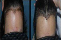 ���ݱ���Ƥ��ר��ҽԺ������ë��ֲԻ�õ�ҽԺ���ļң�