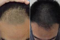 ���ݱ���Ƥ��ר��ҽԺ����ͷ��Ϊʲô������