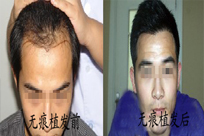 ���ݱ���Ƥ��ר��ҽԺ���������߲���Ի�õĸ��Ʒ�����ʲô��