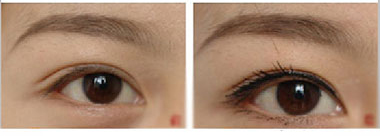 ���ݱ���Ƥ��ר��ҽԺ��ֲͷ������ô�ֵģ�