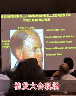 ���ݱ���Ƥ��ר��ҽԺ֬�����ѷ�������ƺ�