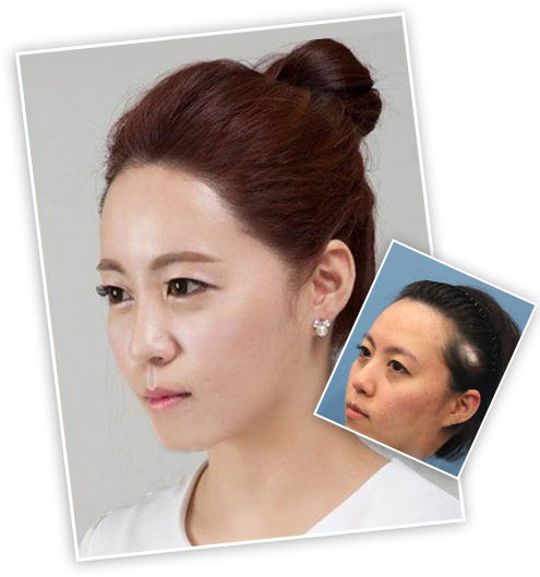 ���ݱ���Ƥ��ר��ҽԺ֬�����ѷ�Ӧ�������