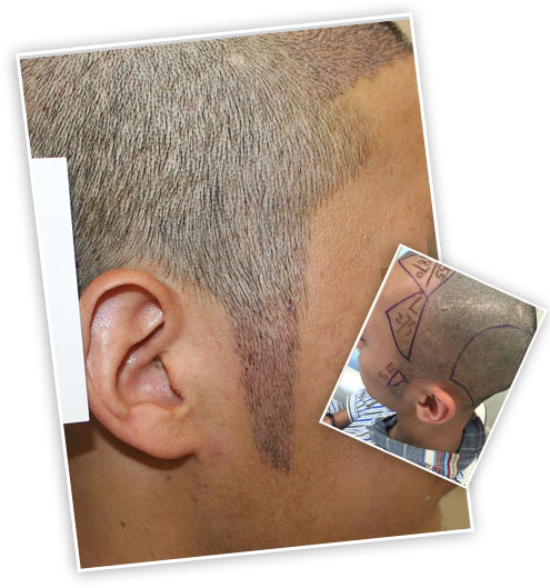 ���ݱ���Ƥ��ר��ҽԺ֬�����ѷ�����Щ֢״����