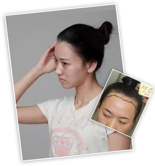 ���ݱ���Ƥ��ר��ҽԺ�ѷ�������ߴ�����Щ