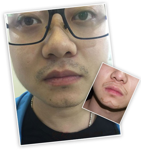 ���ݱ���Ƥ��ר��ҽԺ�ѷ����Ŵ�������