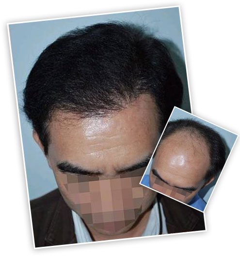 ���ݱ���Ƥ��ר��ҽԺ�ѷ�����ν��л���