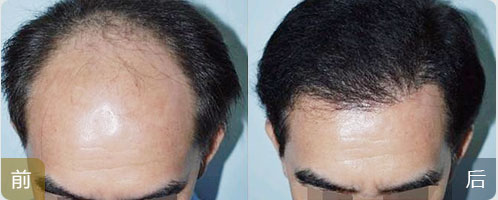 ���ݱ���Ƥ��ר��ҽԺԤ�������ѷ��Ĵ�ʩ����Щ