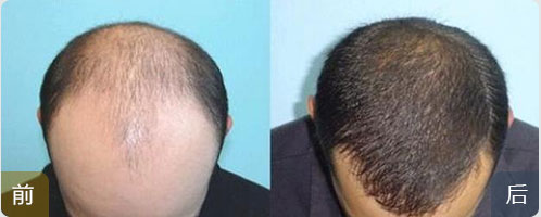 ���ݱ���Ƥ��ר��ҽԺ�޽���ֲ  ������������